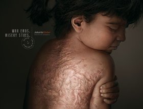 Scars of Misery